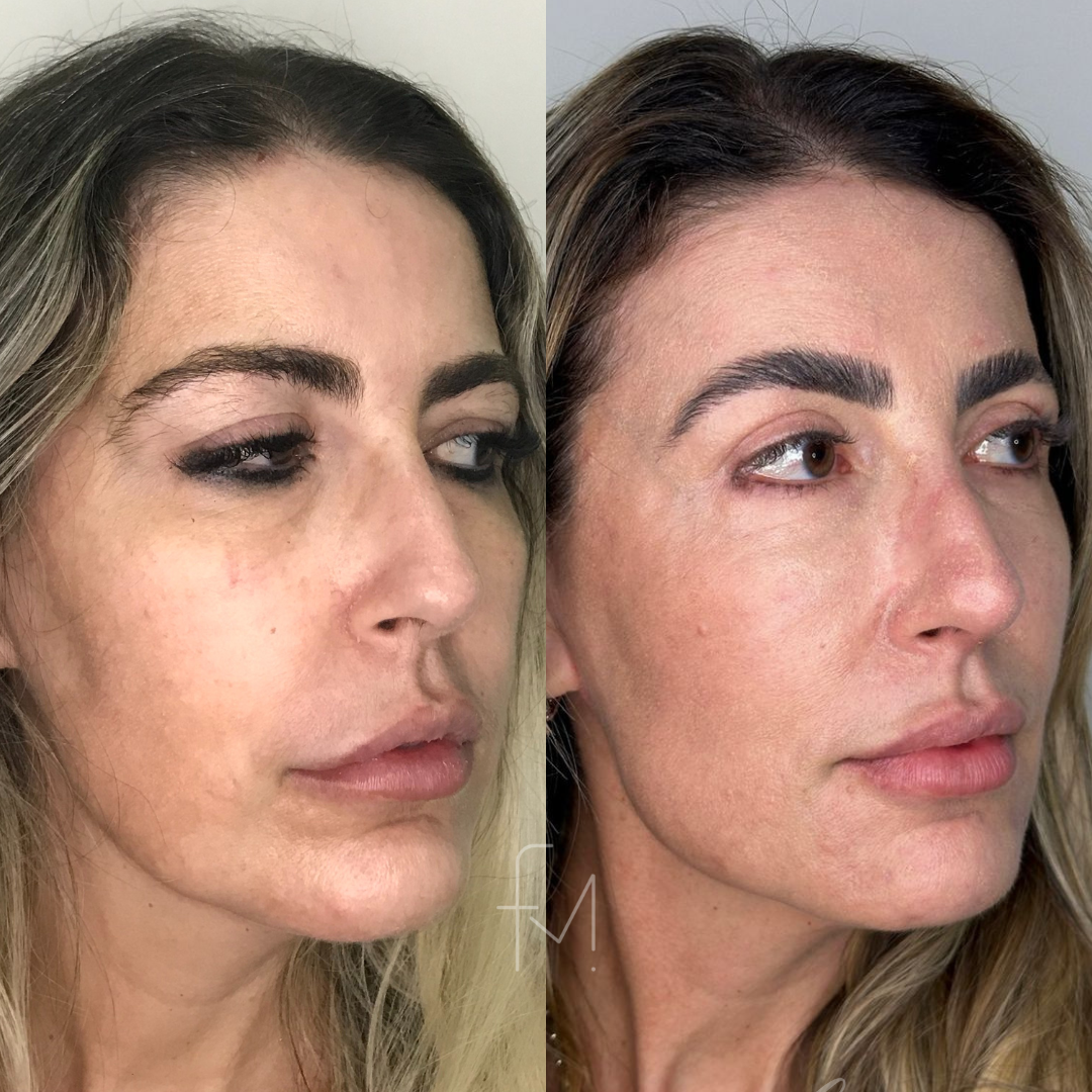 RESULTADOS FERNANDA (54)