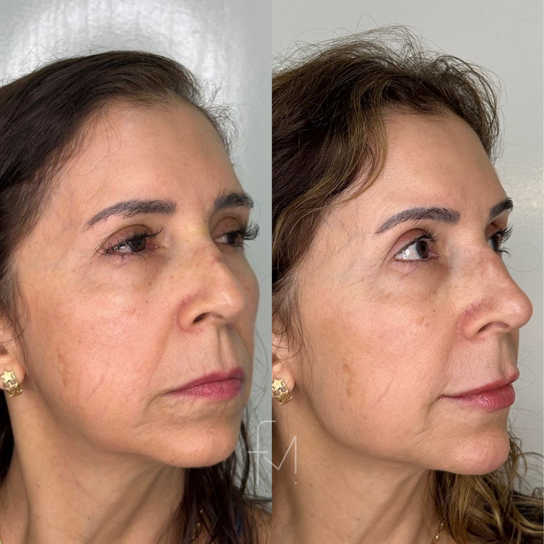 RESULTADOS FERNANDA (57)